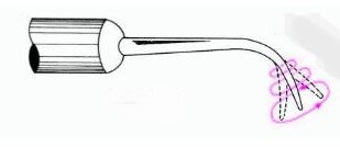 Ultraschall a.JPG