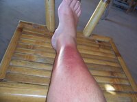 100_3875.jpg