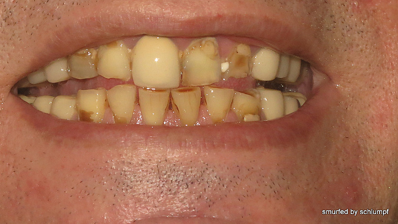 19.11.2013 Smurf Bar