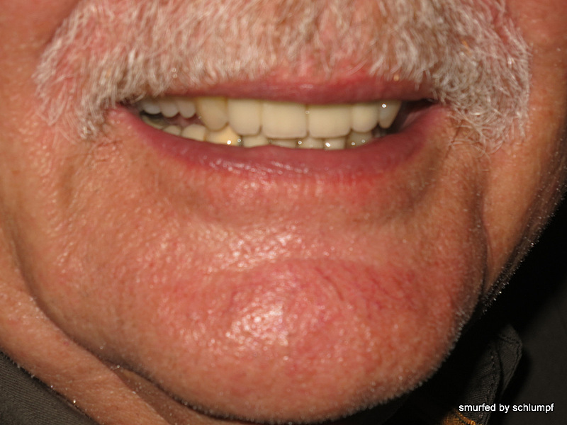 2014-02-05 Smurf Bar