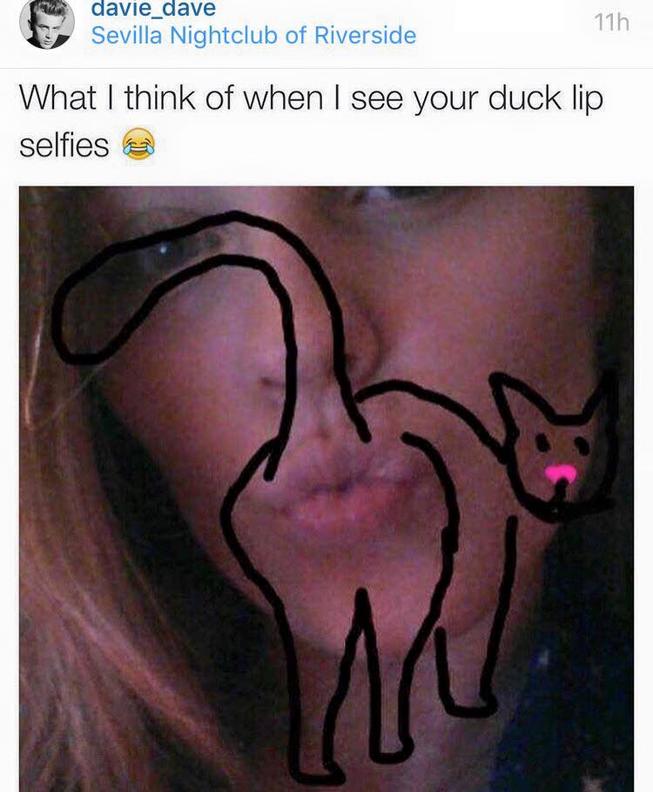 Ducklips
