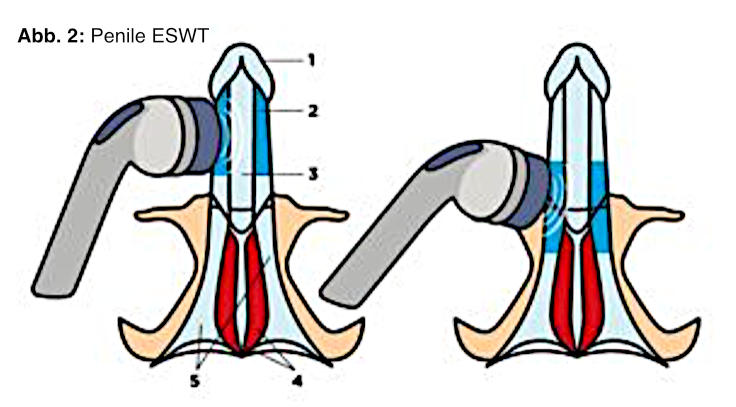 www.urologe-androloge.de